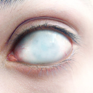 பார்வையற்றோர் போராட்டத்திற்கான அழைப்பு!